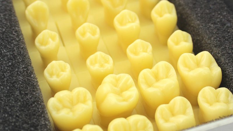 儿童牙齿矫正，价格几何？揭秘影响费用的关键因素**